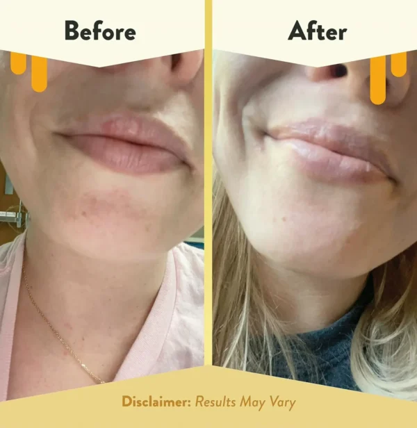 Nurture Lips - Organic Lip Balm for Delicate Lips