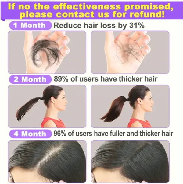 Rosemary Serum for Hair Growth - Dual Pack + Scalp Massage Tool