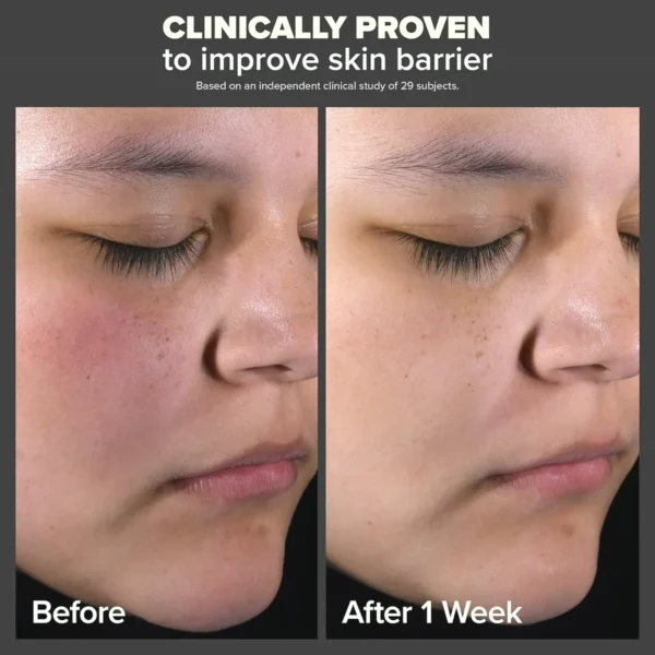 Paula Selection Two Percent Beta Hydroxy Acid Skin Exfoliator to Treat Pores
