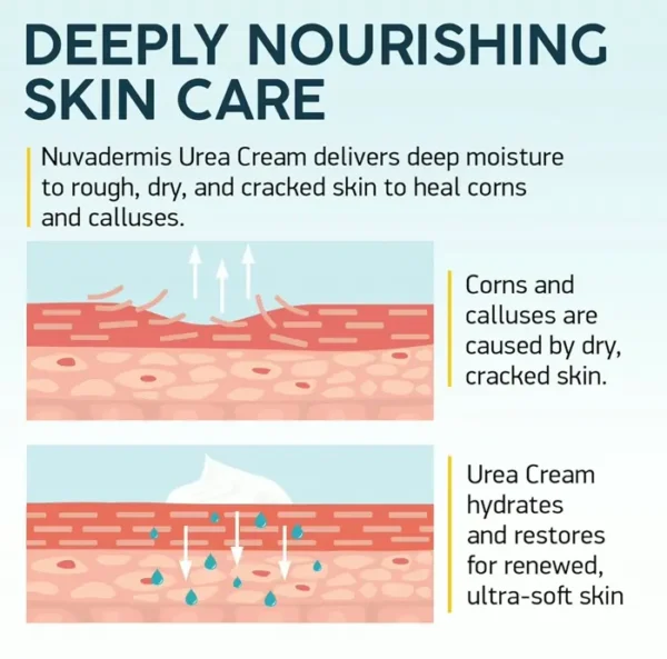 Urea Lotion 40% for Feet - 2% Salicylic Acid - Jar