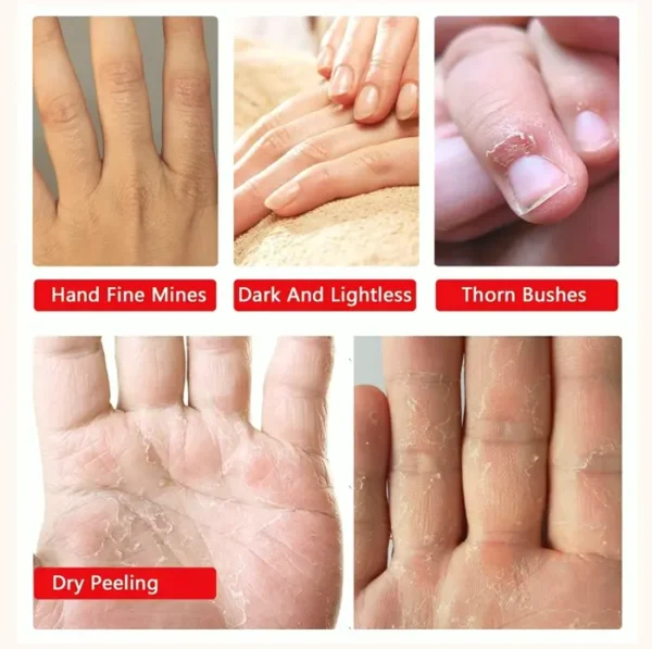 Set of 4 Hands Hydrating Glove Mask for Cracked Hands