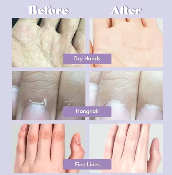 Ultra Soft Hand Treatment includes Five Pairs for Rough Hands